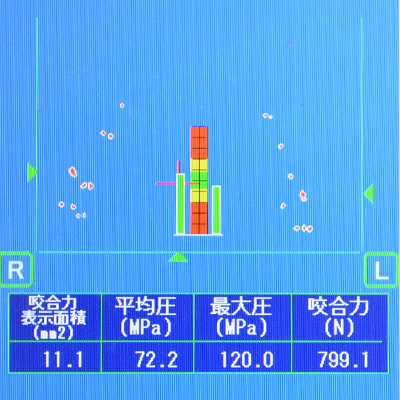 レントゲン