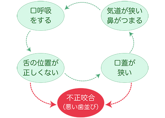 歯ならびが悪くなるスパイラル